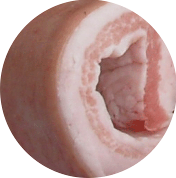 Ventresca